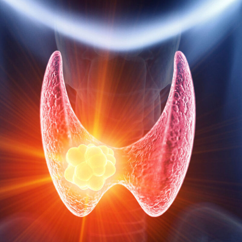 Animated Image of Thyroid Optimization