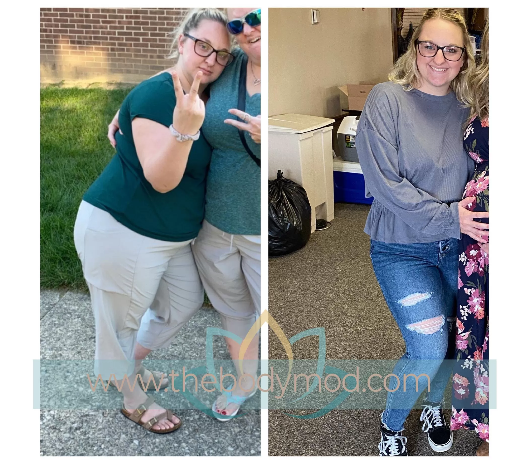 Before and After Images of Woman Showing Weight Loss