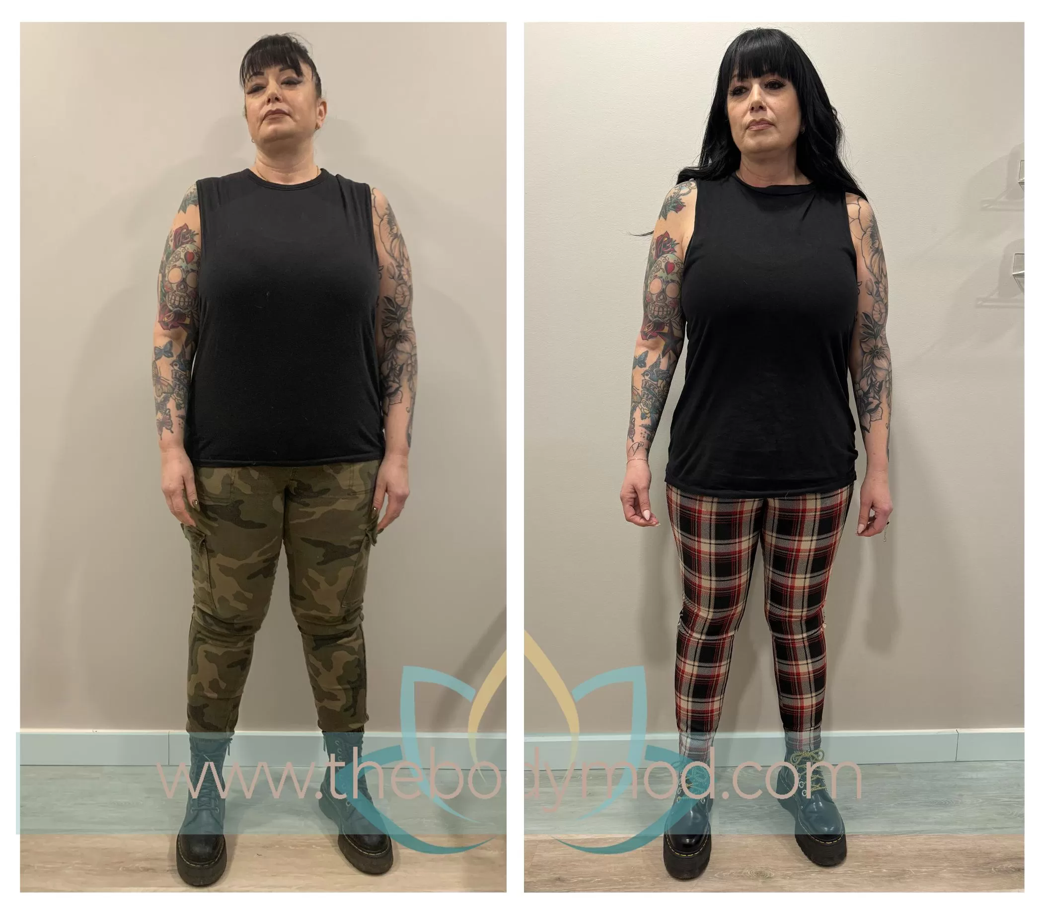 Images of Dark-Haired Woman Showing Before and After Weight Loss