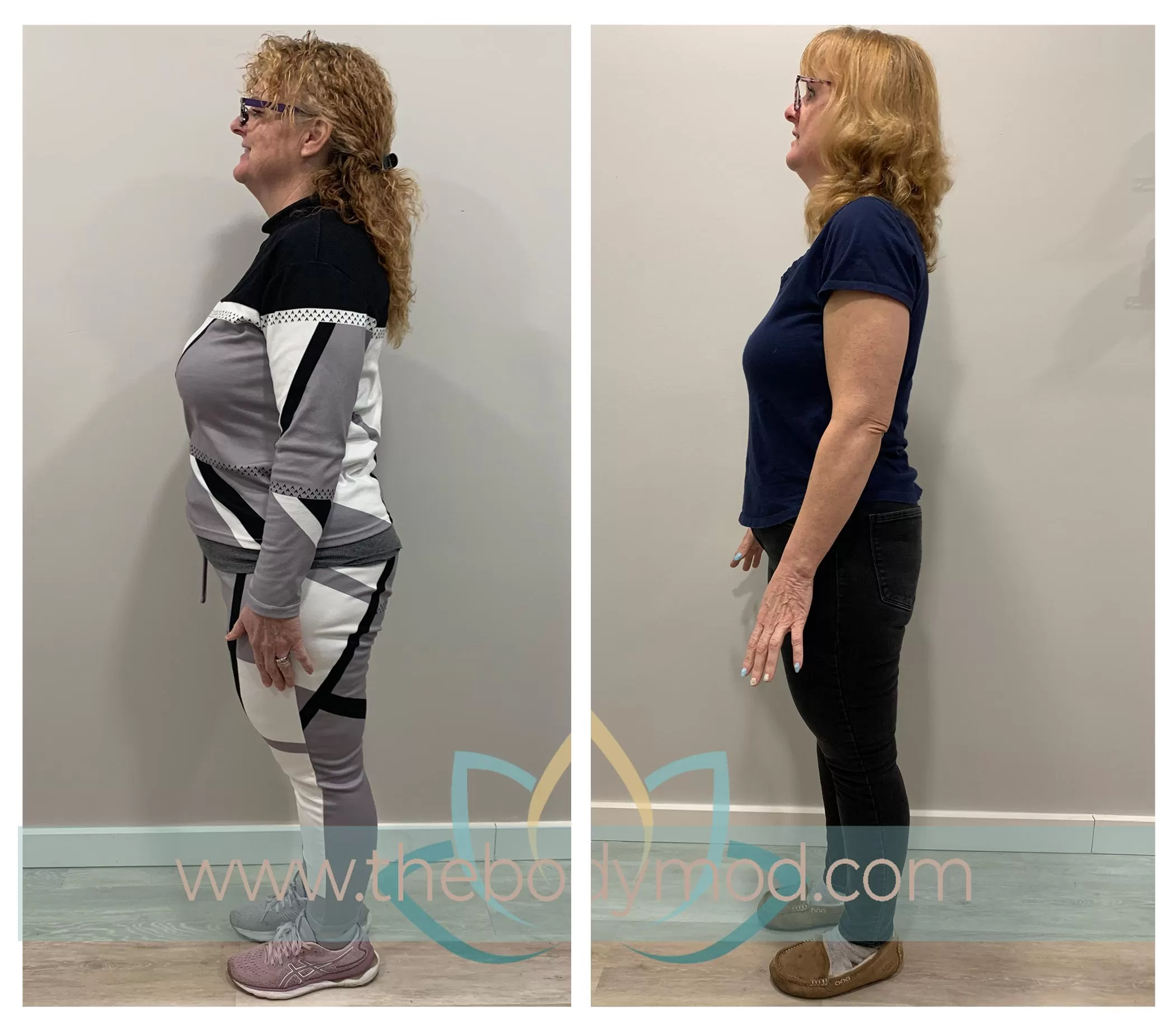 Side Profile Images of Woman Showing Weight Loss