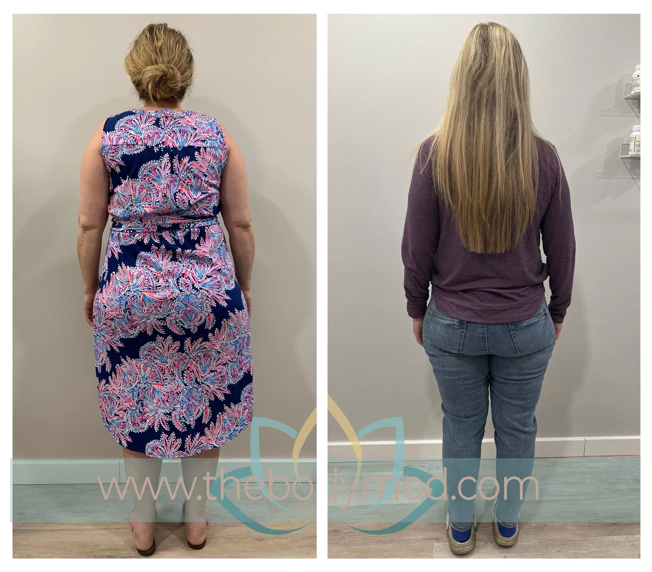 Woman Turned Away Showing Before and After Weight Loss Images