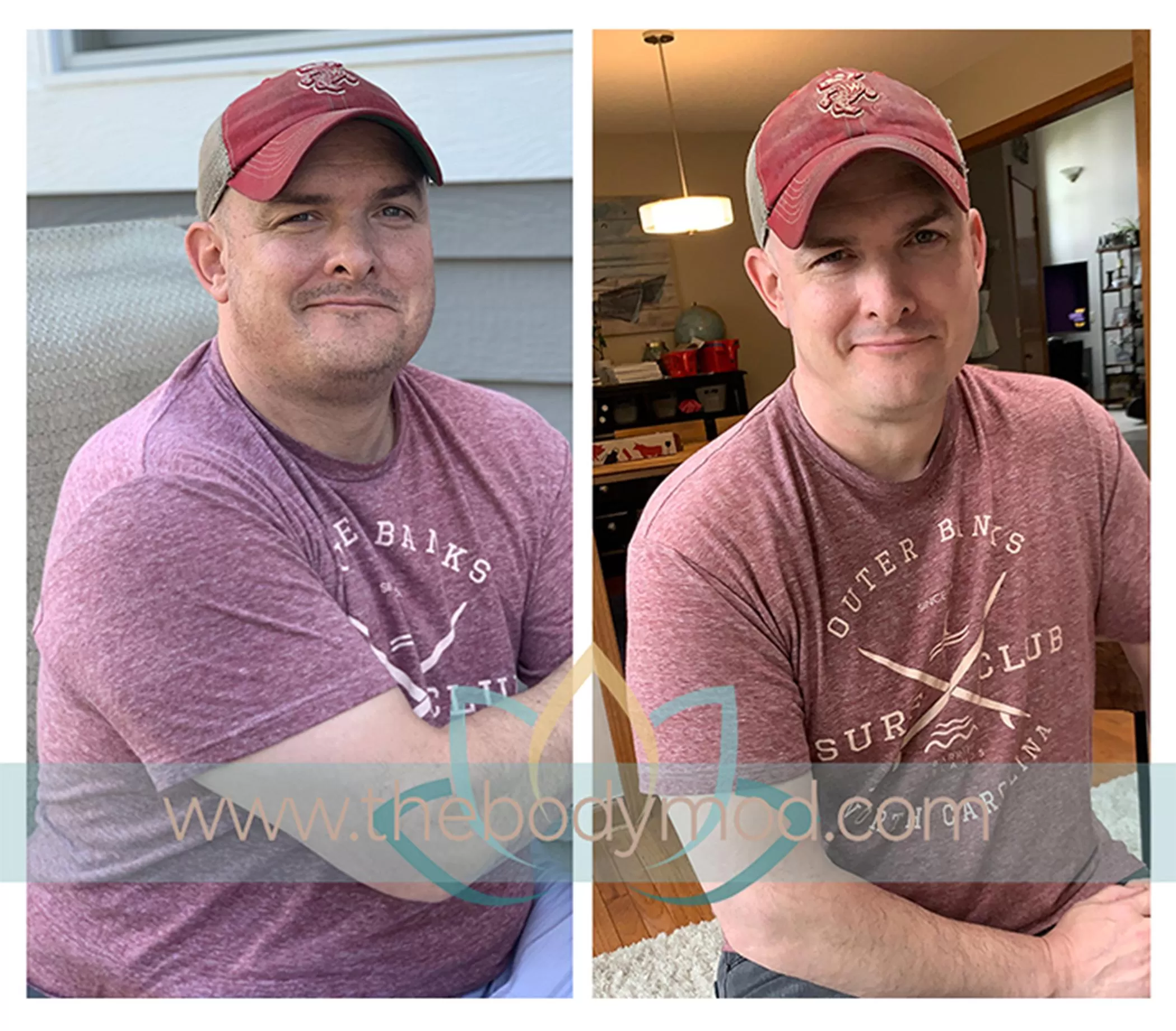 Man Showing Weight Loss in Before and After Images