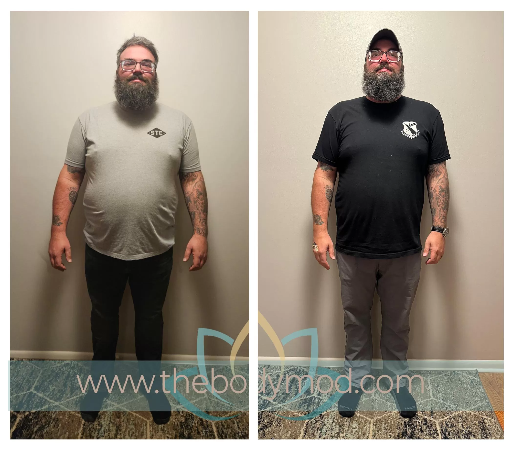 Bearded Man Showing Weight Loss in Before and After Images